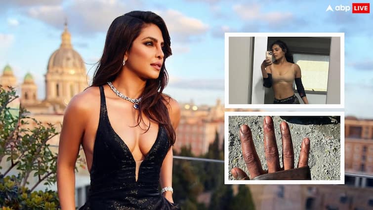 Priyanka Chopra share Fake Blood in Latest Post clarifying that it was all makeup Priyanka Chopra के चेहरे पर खून ही खून! ब्लड वाली फेक तस्वीरें देख फैंस हैरान-परेशान