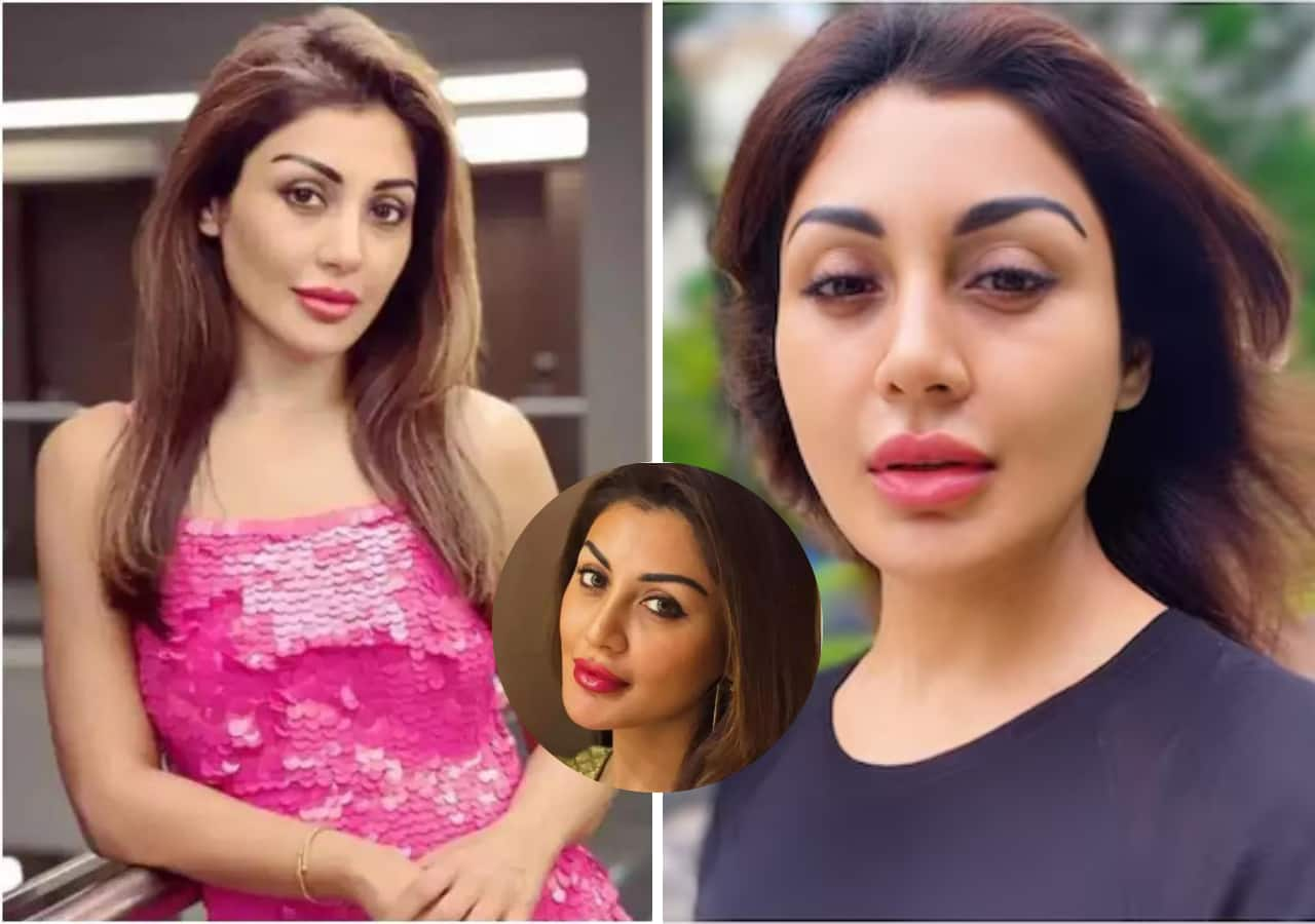 Rimi Sen, Ayesha Takia and other celebs whose beauty treatments went wrong, check before and after pics